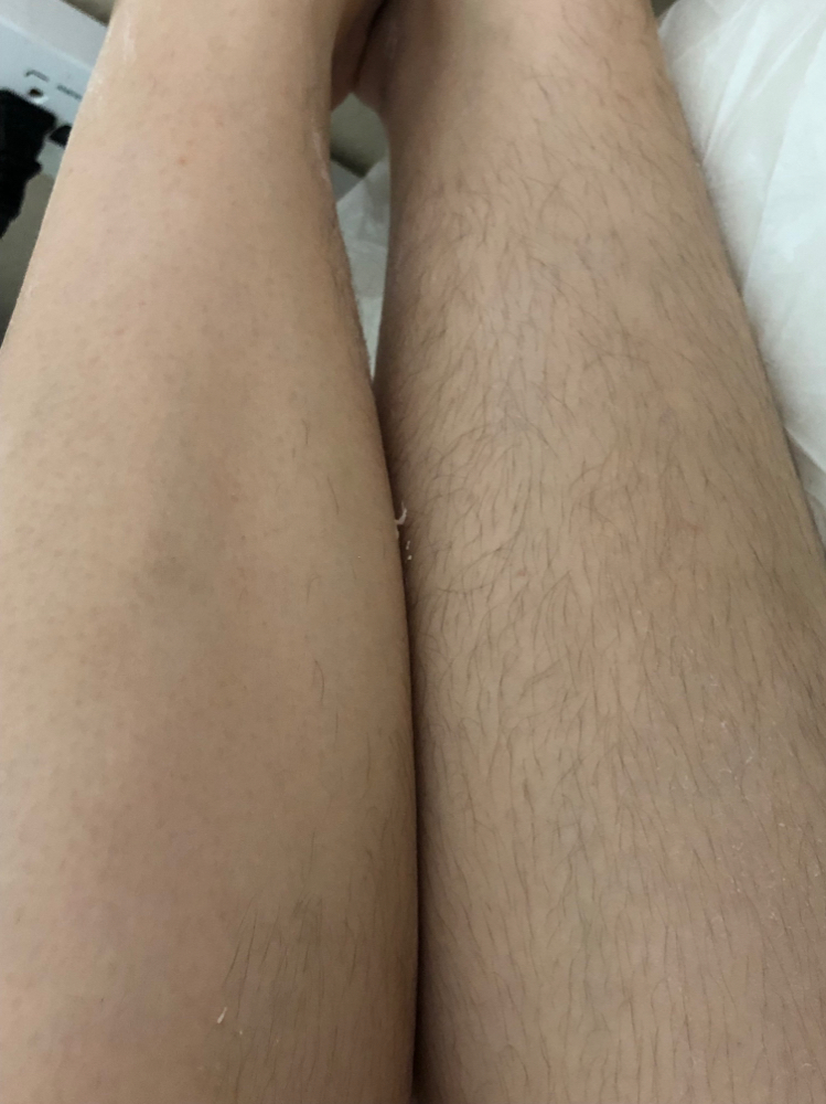 Full Legs Waxing