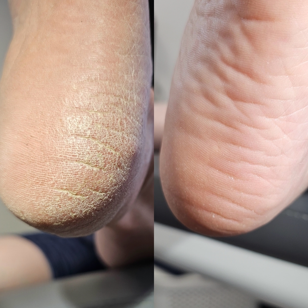 Advanced Pedi - Established Clients at Nailz by Cherie in Billings, MT