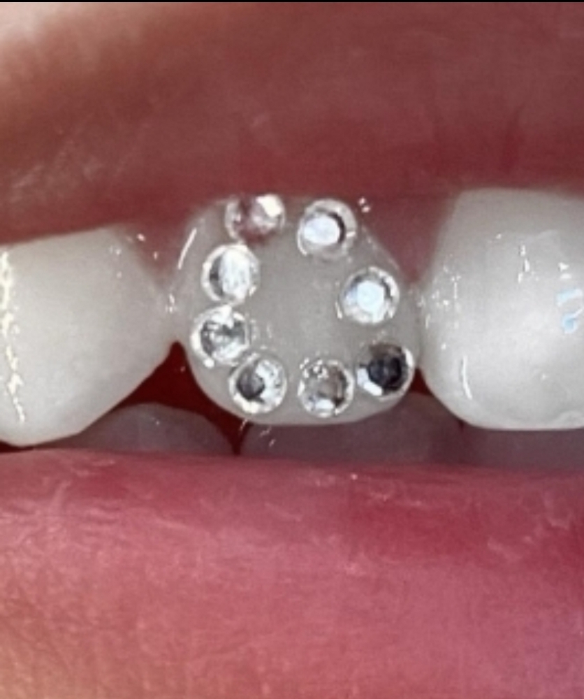 Halo Tooth Outline