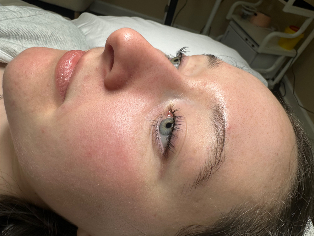 Lash lift