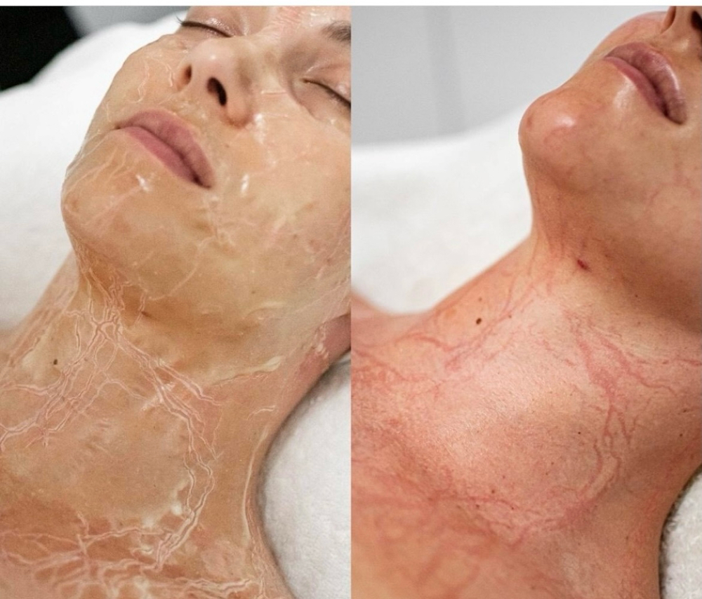 Luxe Lift Facial