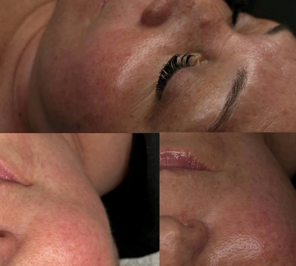 Custom Facial at EstheticsByMich in Mount Prospect, IL