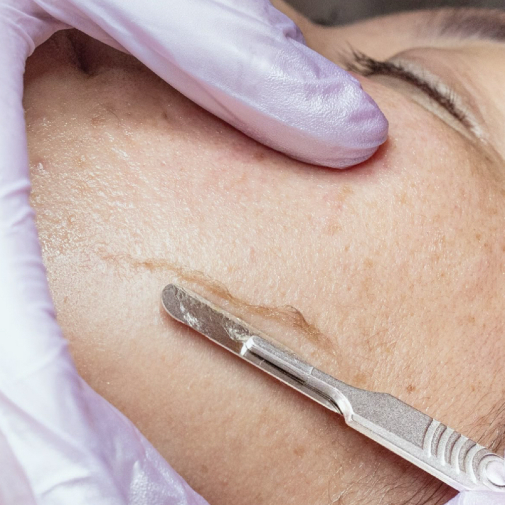 Glow-Getter Dermaplane Facial at AC SKIN STUDIO in Knoxville, TN