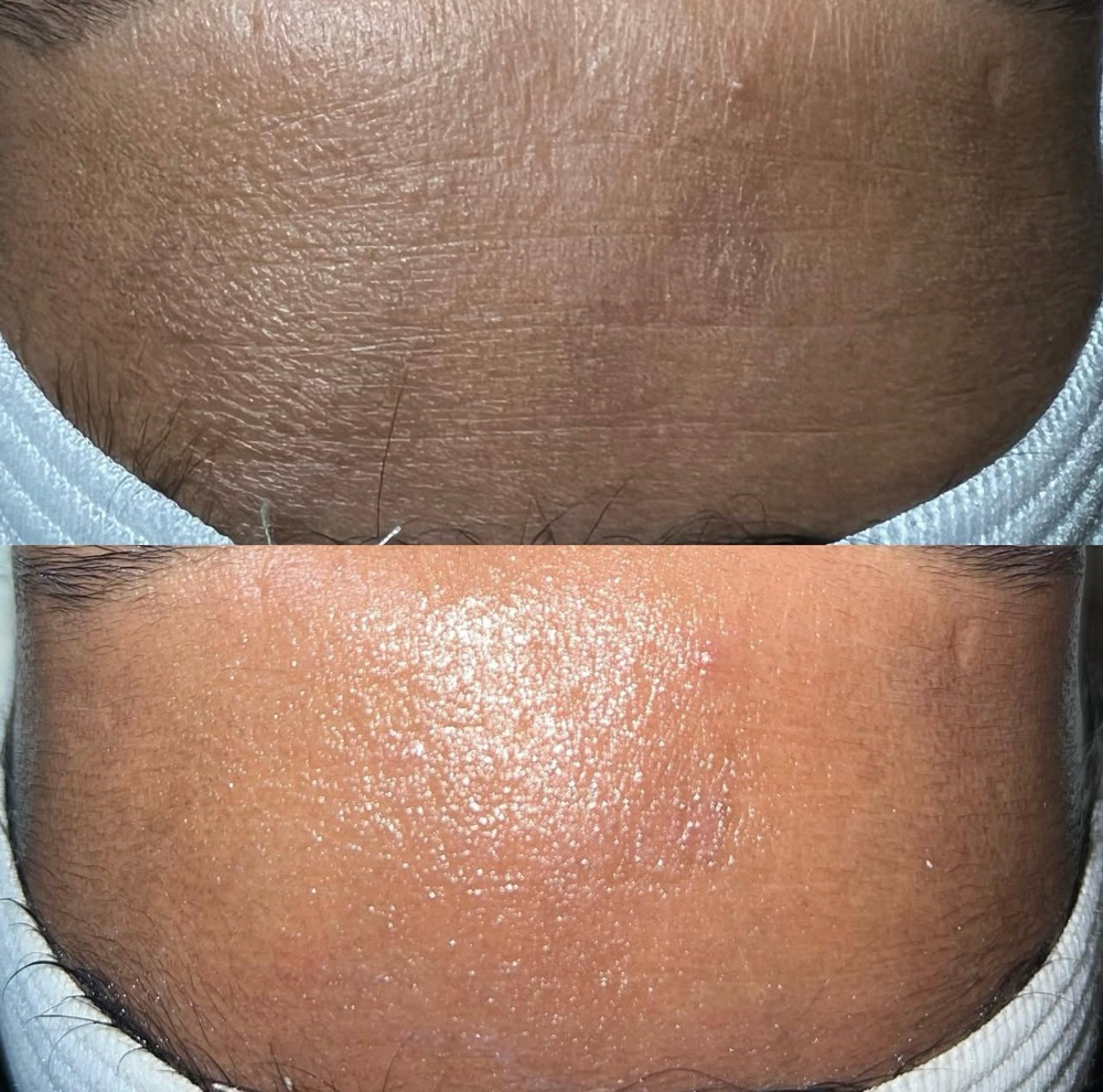 Anti-aging Facial at Glow by Jess in Troy, MI