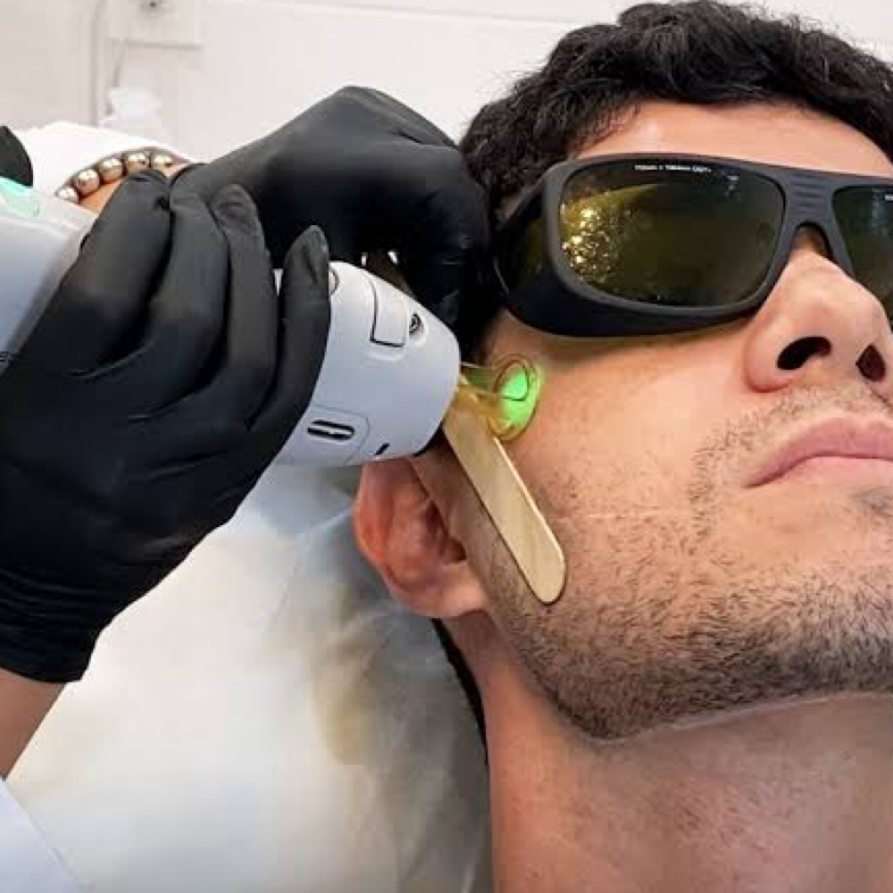 Laser Hair Removal - MEN UPPER BODY at SKIN + BODY Aesthetics in Troy, MI