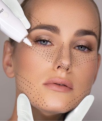 FibroBlast ✨ at SALTY MANGO STUDIO in San Juan, PR