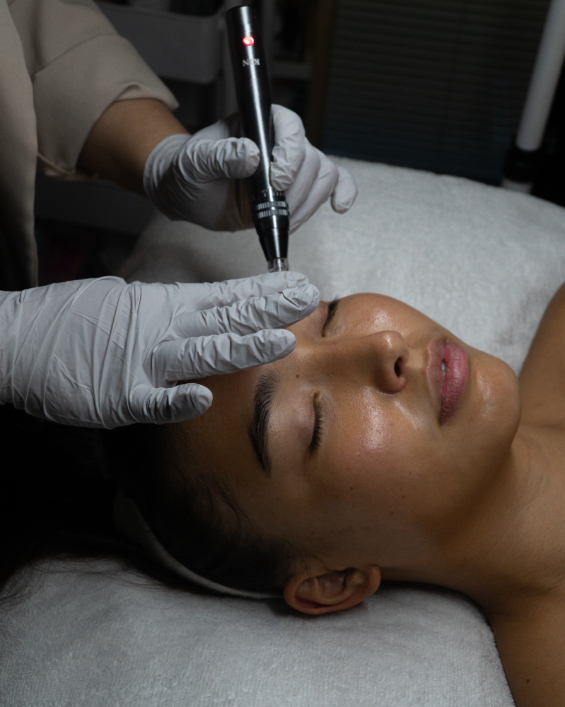 Nanoinfusion + Peel Package