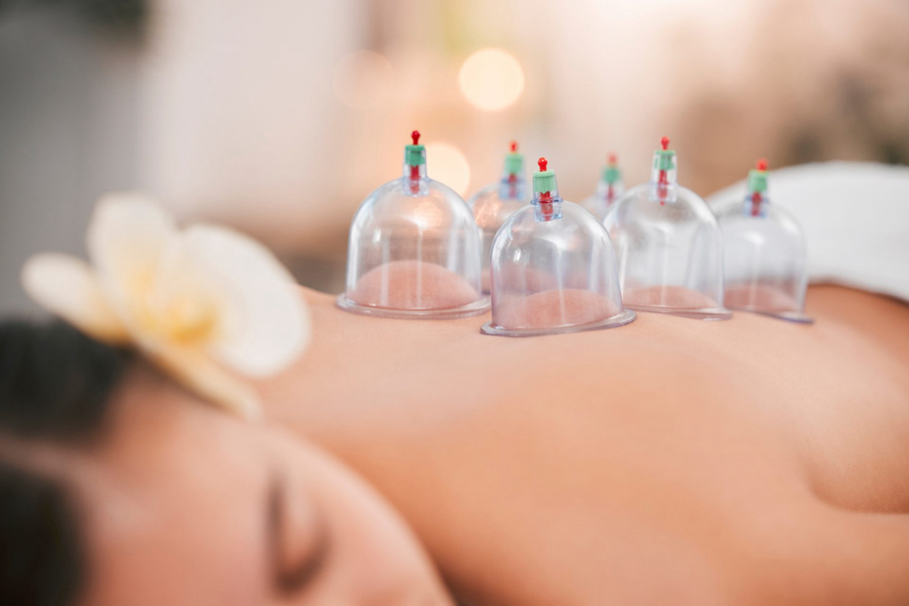 Cupping Add On
