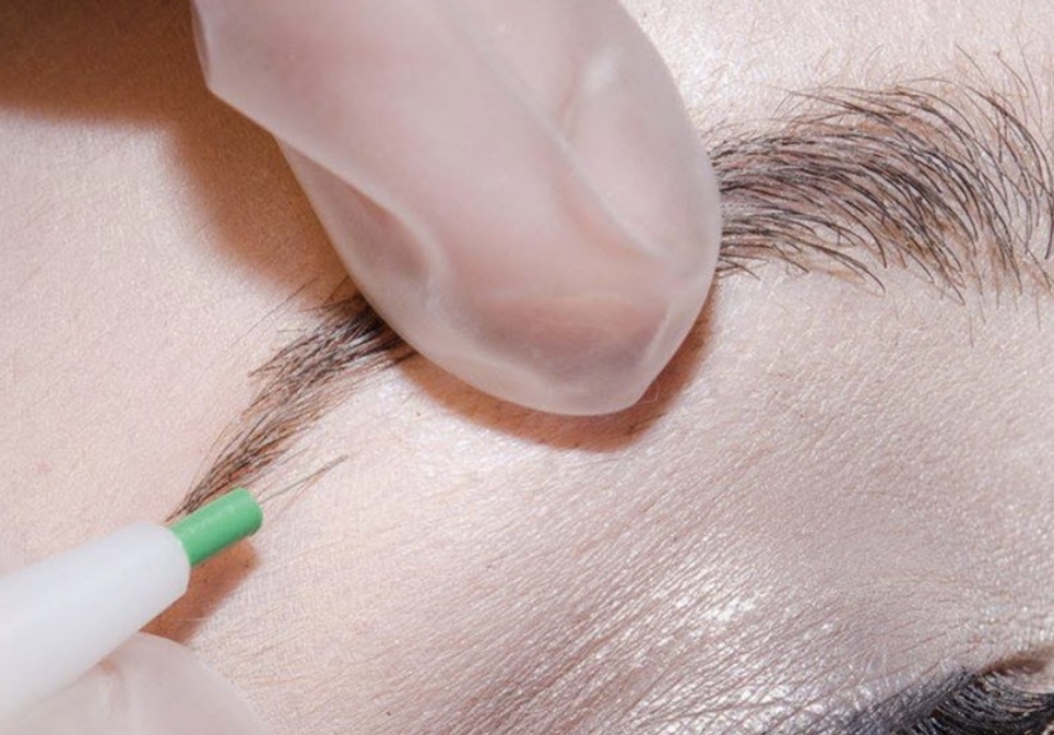 Electrolysis 15 Minute Session
