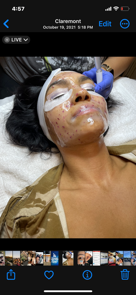 SugarLab Micro-Delux Facial