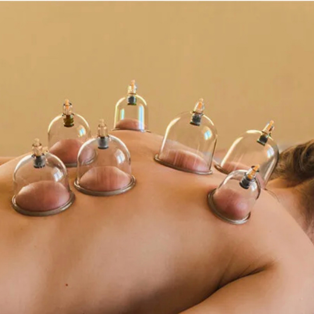 Cupping Therapy at KC Beauty by Katherine Cheng in Beverly, MA