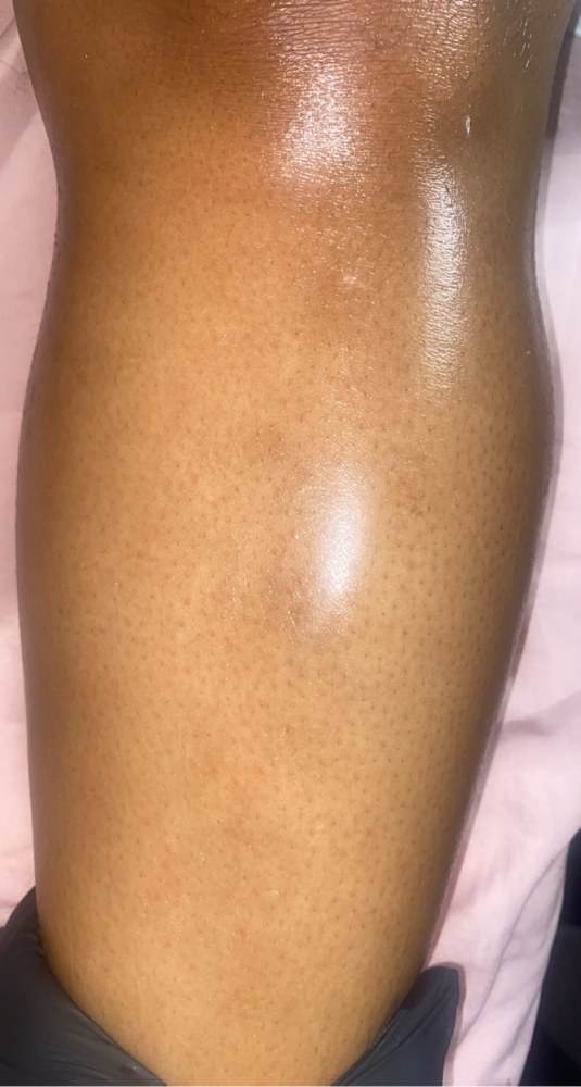 Leg Wax