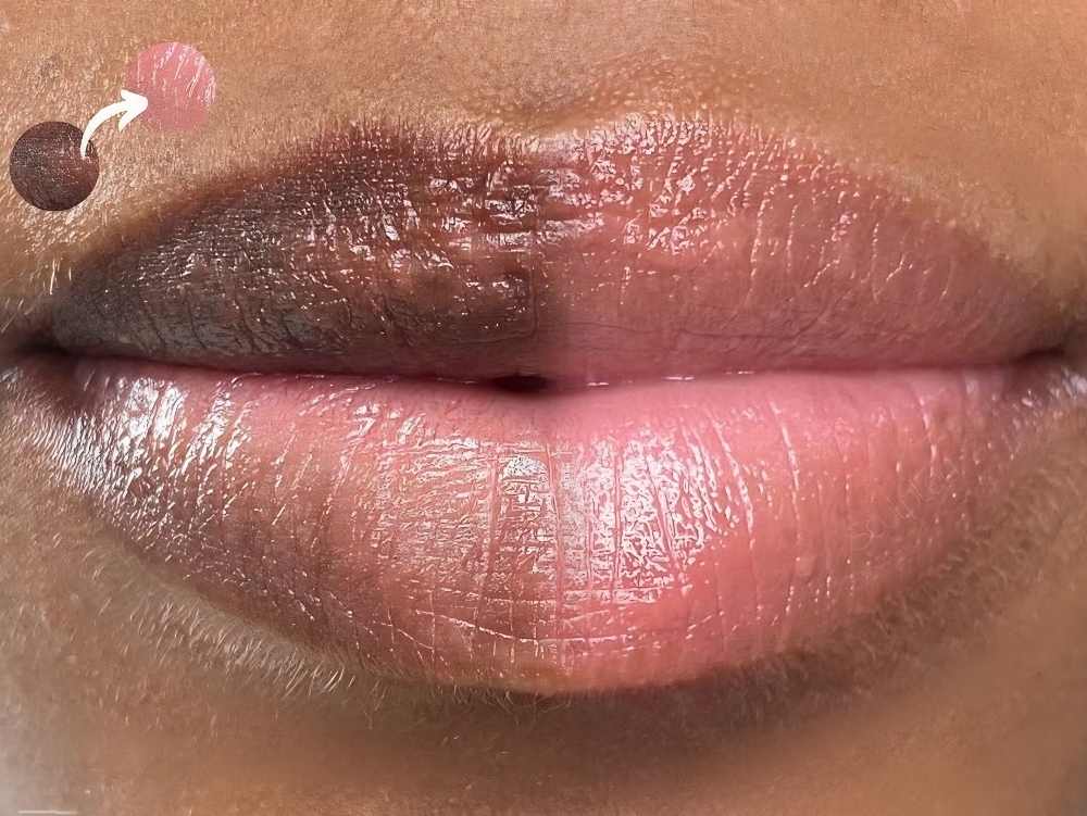 LIP NEUTRALIZATION