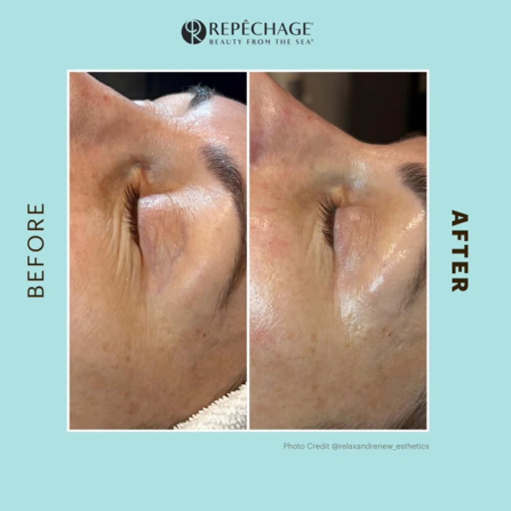 Opti Firm Eye Care Treatment 💫 at Kiersten  Grisham in Peculiar, MO