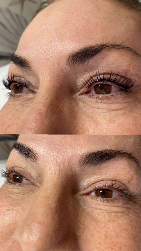 Lash Lift