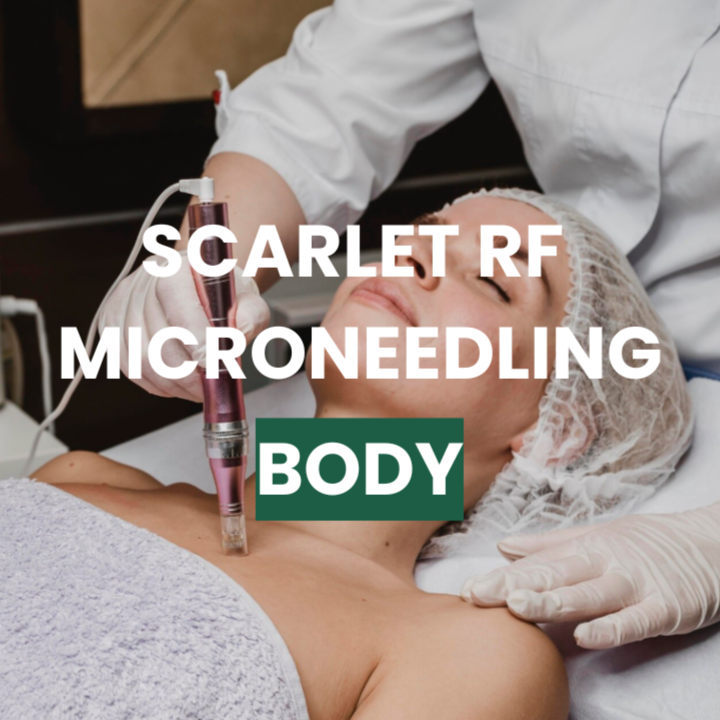 SRF Body Microneedling- Single Area at Snap Medical Wellness in Libertyville, IL