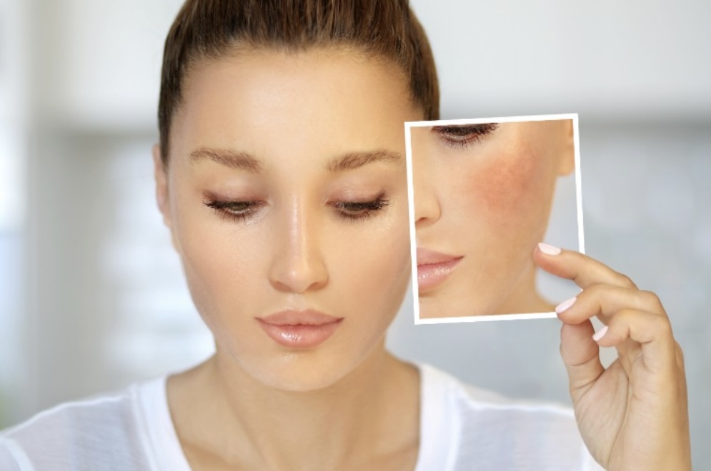 Glo Hydra Bright Facial