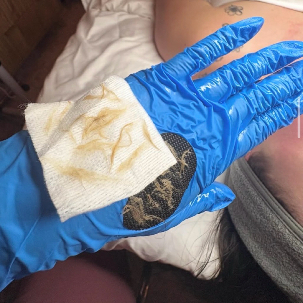Dermaplane Add On at ESWesthetics LLC in Wapakoneta, OH