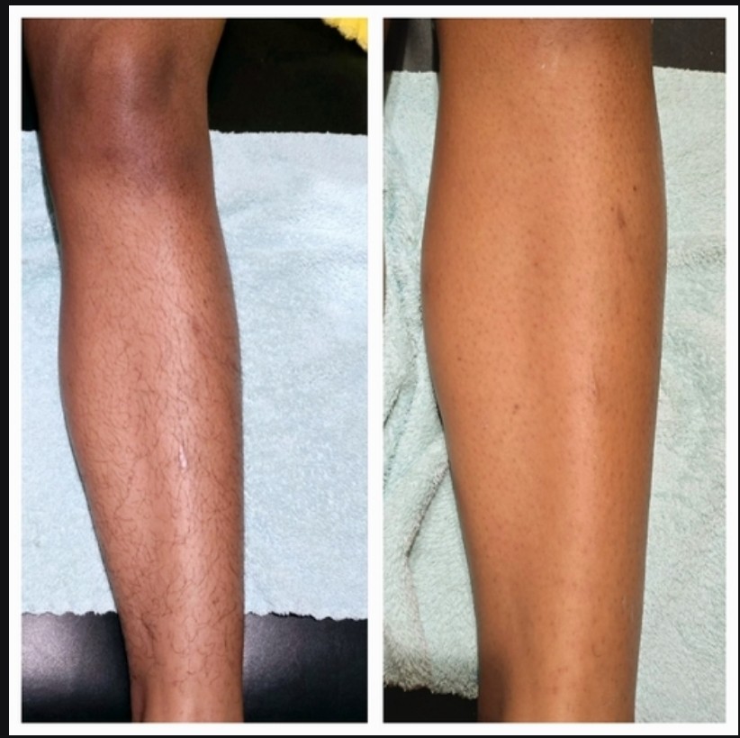 Lower Leg Waxing