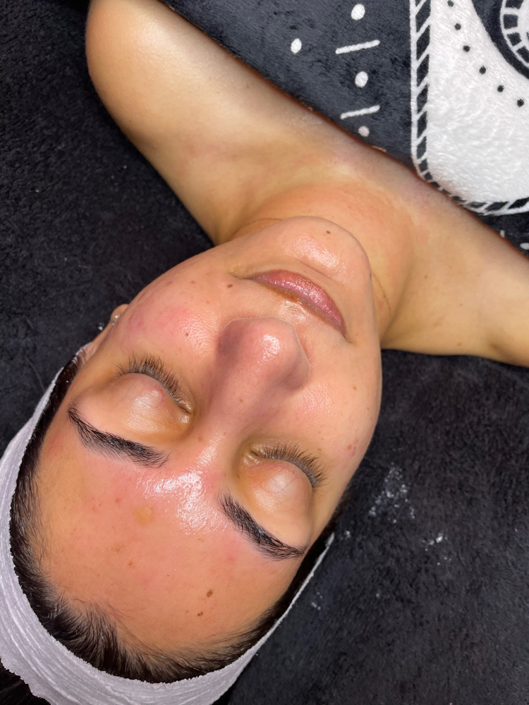 Nano-Infusion Facial