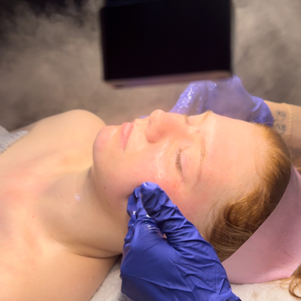 Dermaplaing Glazed Donut Facial