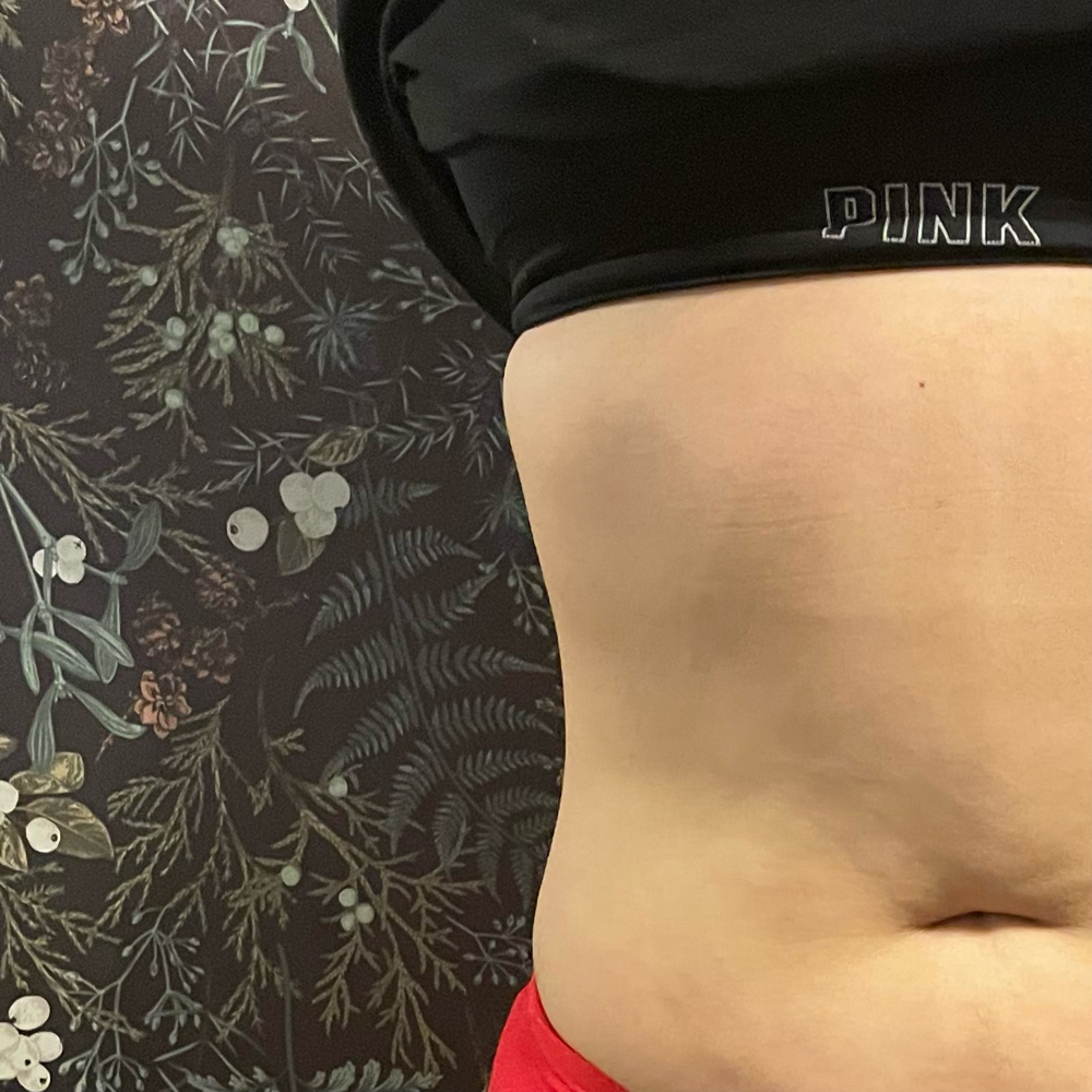 Abdomen Fat Dissolve
