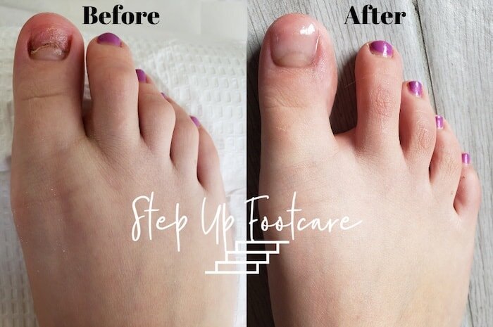Acrylic Repair Each/Big Toes
