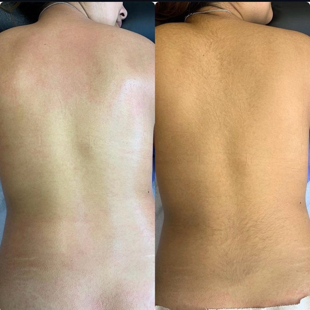 Back Wax at Majestic Touch Aesthetics and More in Camden, AR