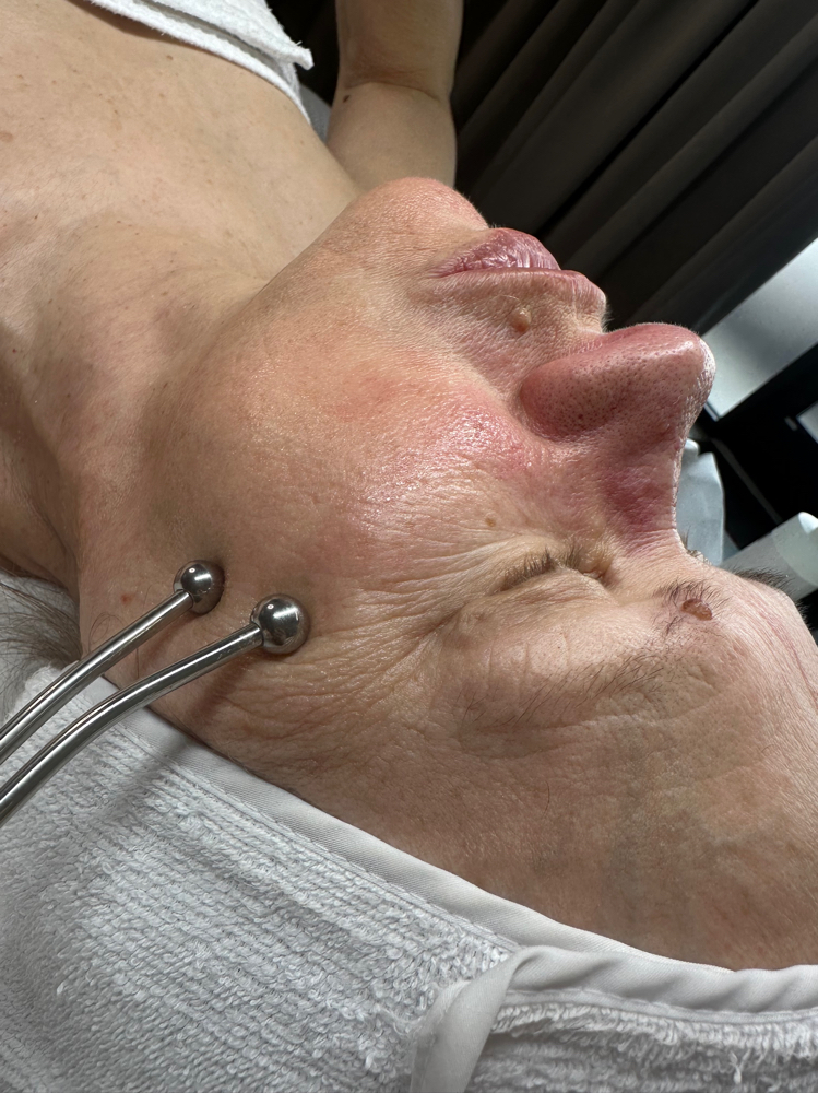 HydroFacial Treatment