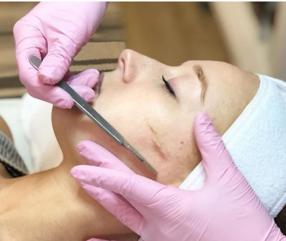 Dermaplane Facial