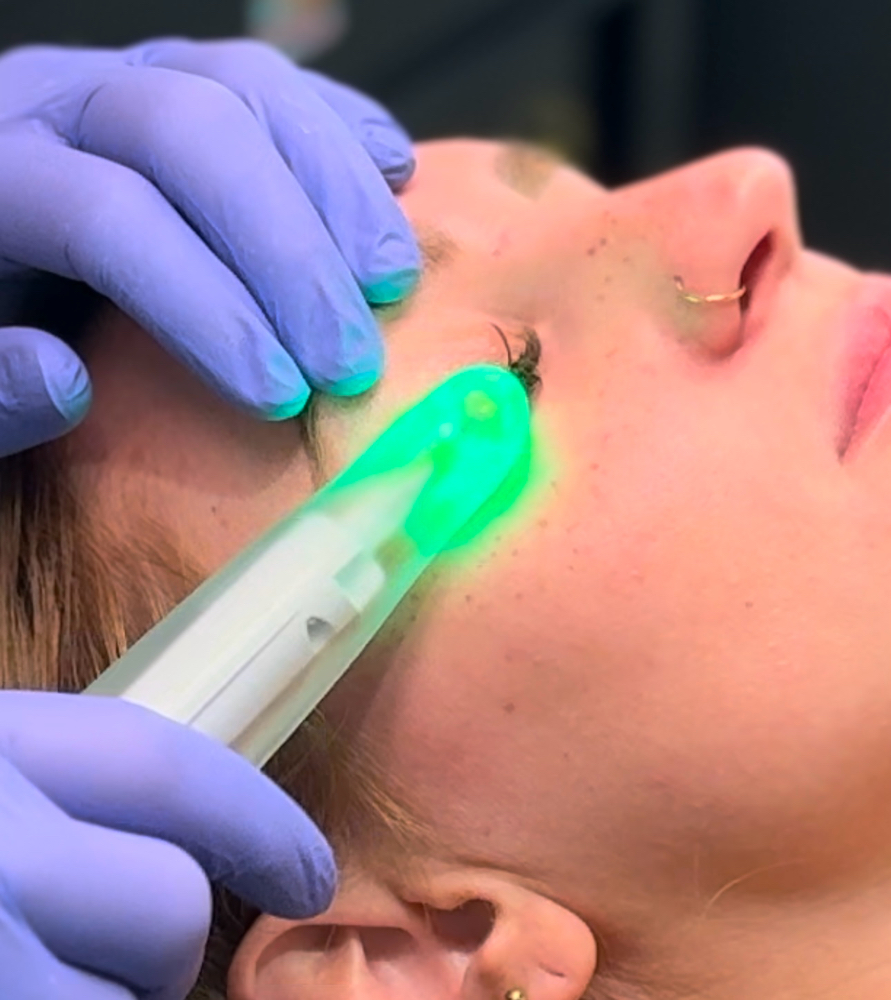 Lash Fill With Ocular Hygiene