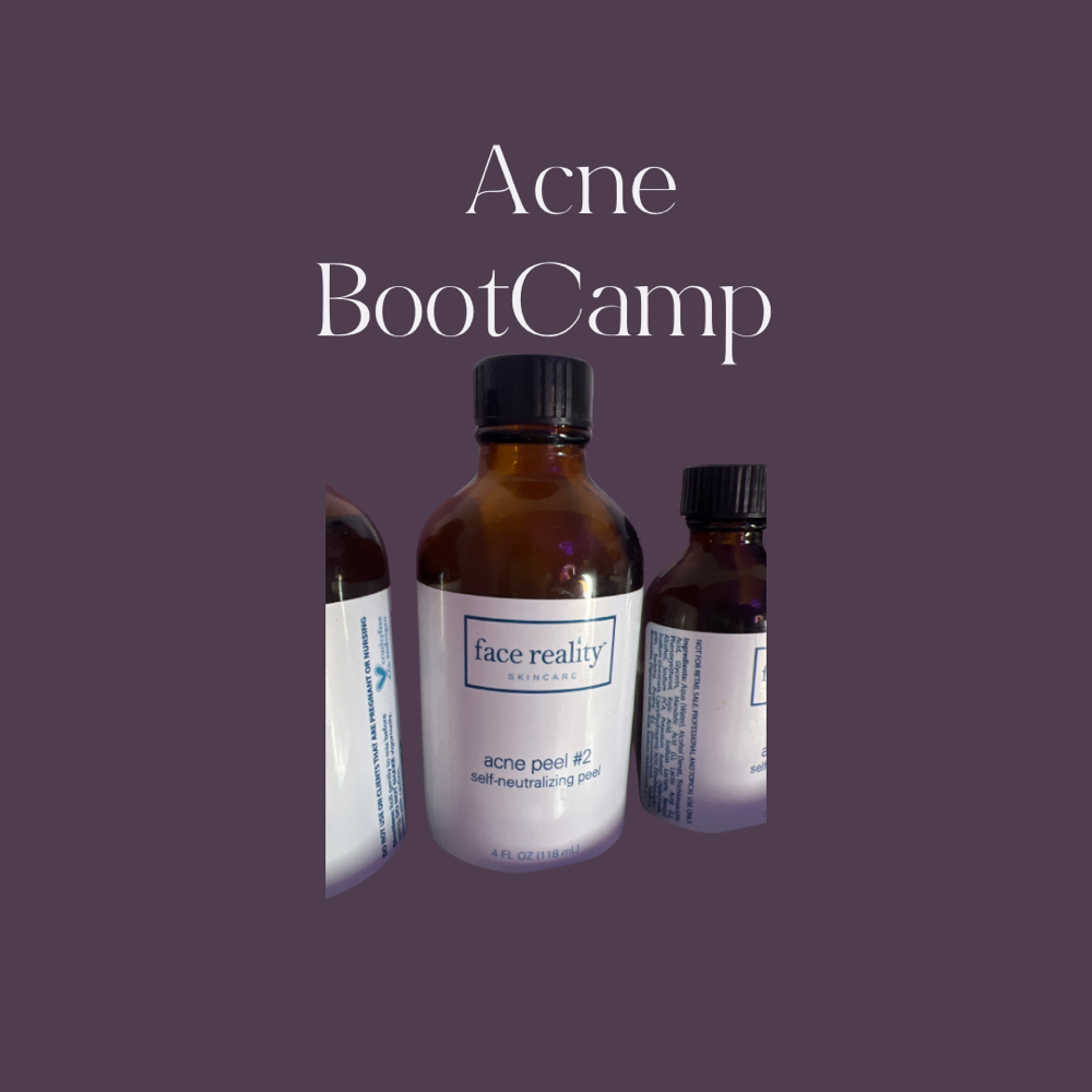 Acne Boot Camp Treatment