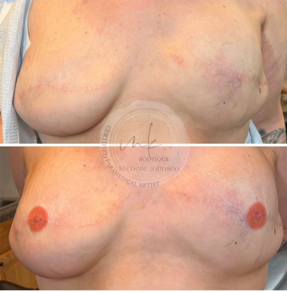 Areola Micropigmentation at Mjartistry in Manahawkin, NJ