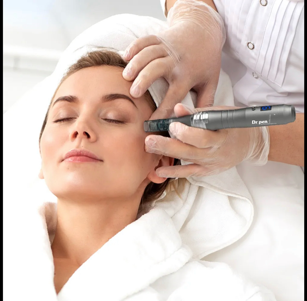 Microneedling