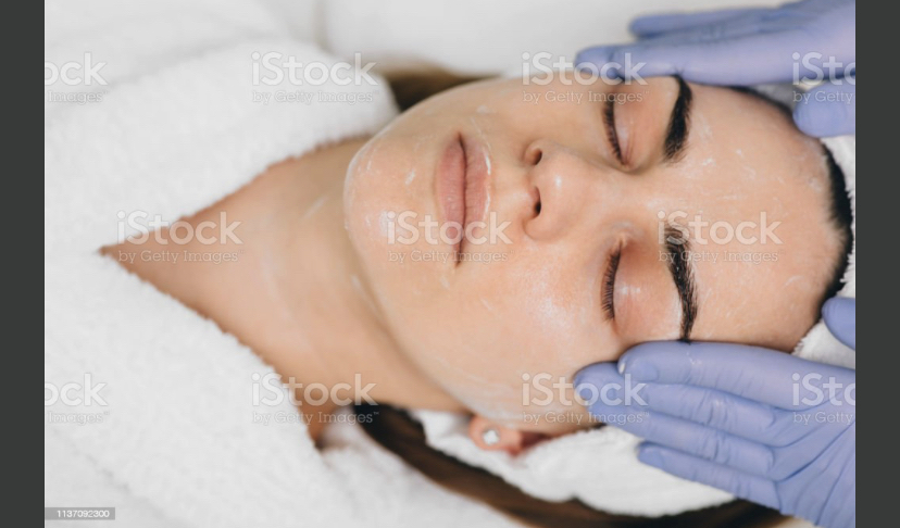 Acne Facial