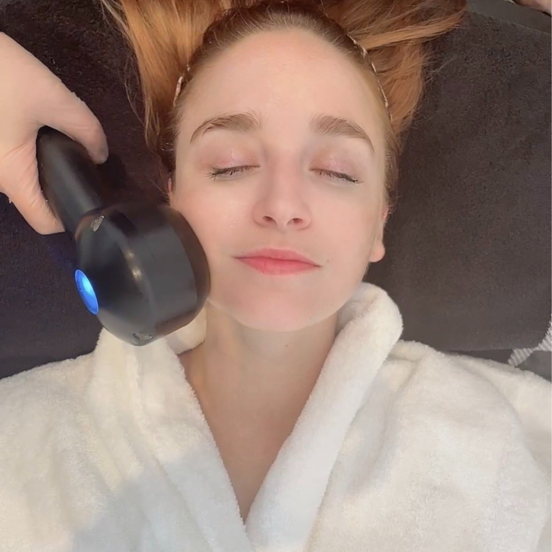 EMBERFEST CRYO FACELIFT UPGRADE at Shapetress in Santa Monica, CA