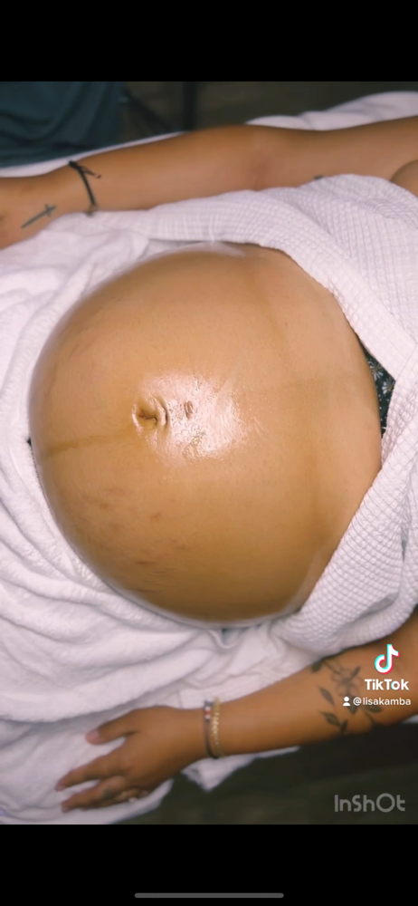 Pregnancy Facial