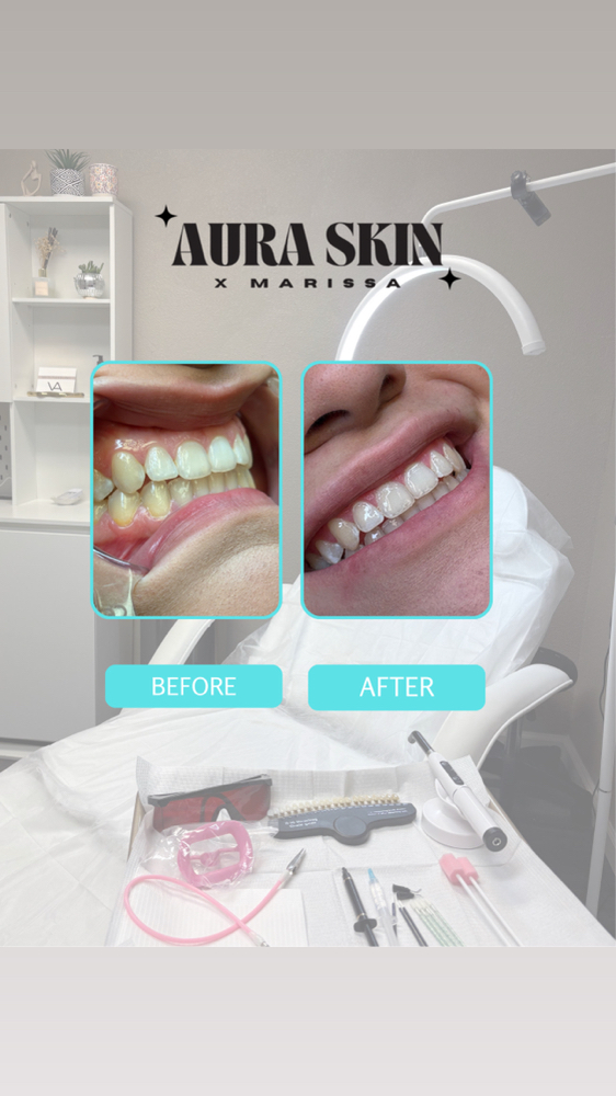 60 min Ultimate Glow at Aura Skin x Marissa in Alice, TX