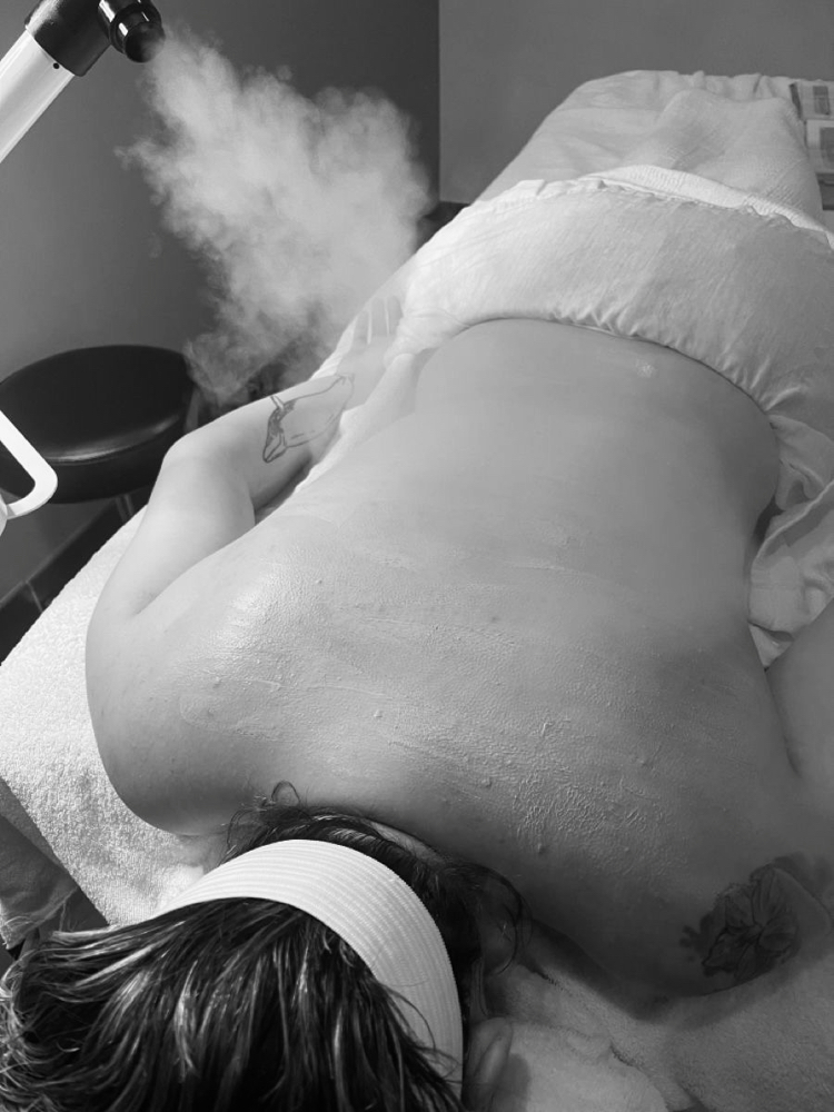 Back Facial at Holy Glow Aesthetics in Pueblo, CO