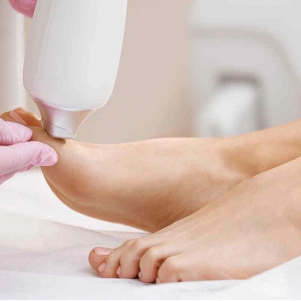 Feet Laser Hair - 5 Sessions at Blessed & Bare Laser Studio in New York, NY