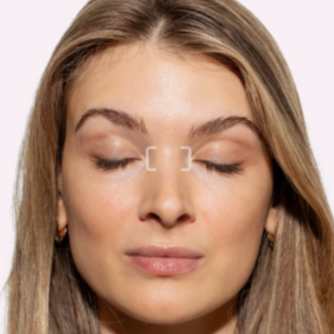 Bunny Lines Tox at Injections by Leighanna in Clarksville, IN