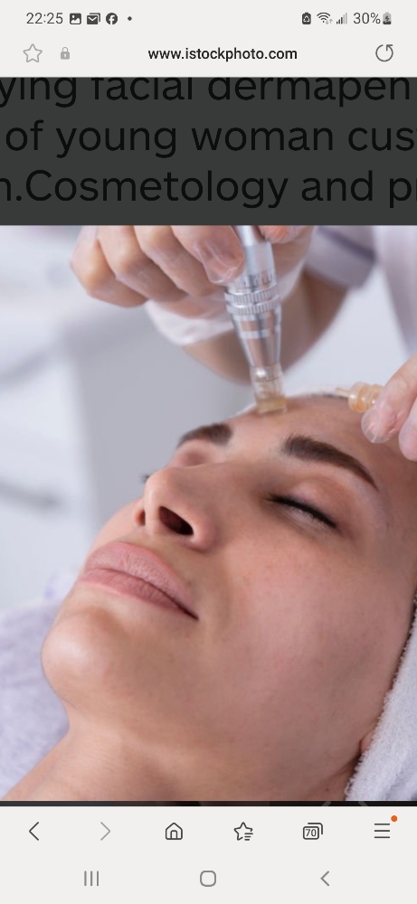 Mirconeedling Therapy(non Invasive)