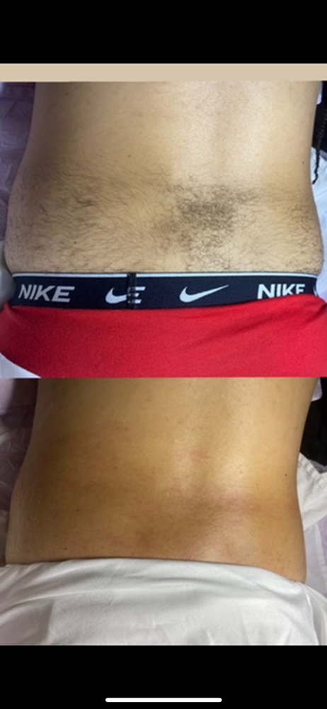 Lower Back Wax at Desthetics Beauty in Bronx, NY