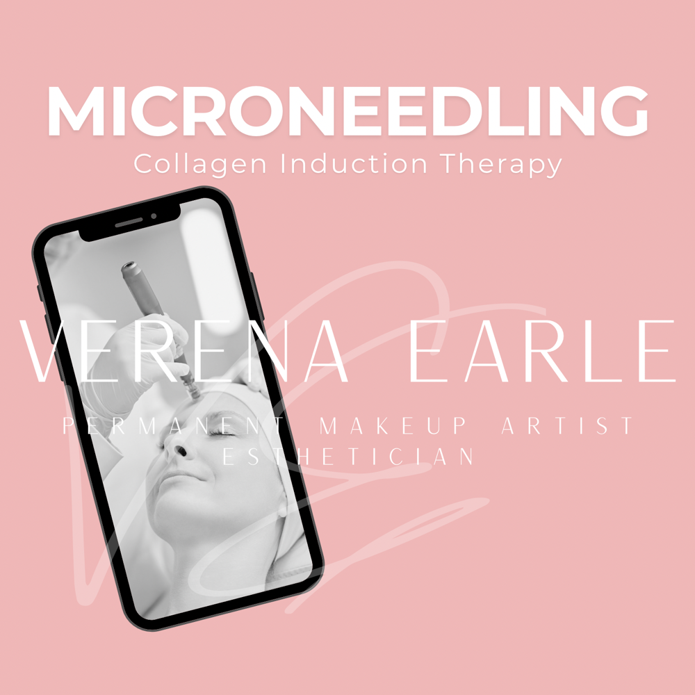 Microneedling