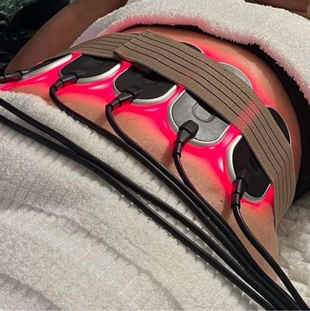 ✨ Laser Lipolysis Body Sculpting ✨ at CELEBRITY HAIR in Houston, TX