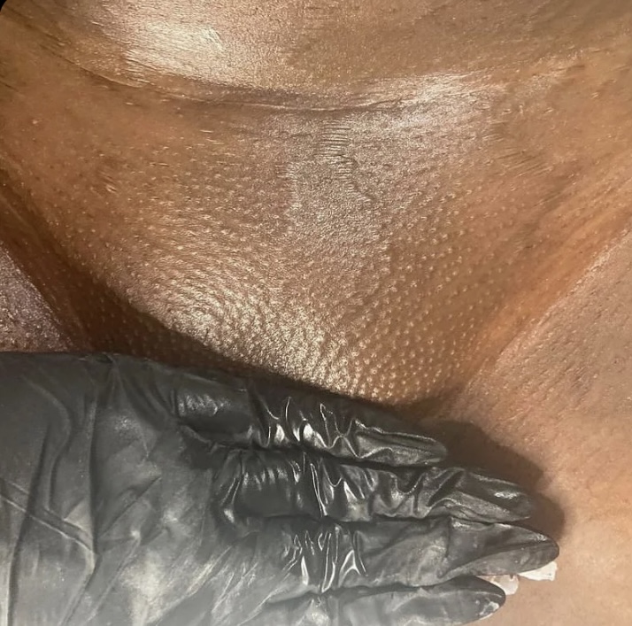 Lady Luxe Custom Vajacial at ZhaneElite Body&beauty in El Cajon, CA