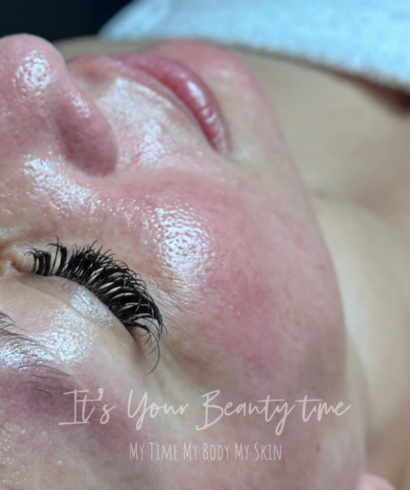 Glass Skin $700 3Treatments $275-1