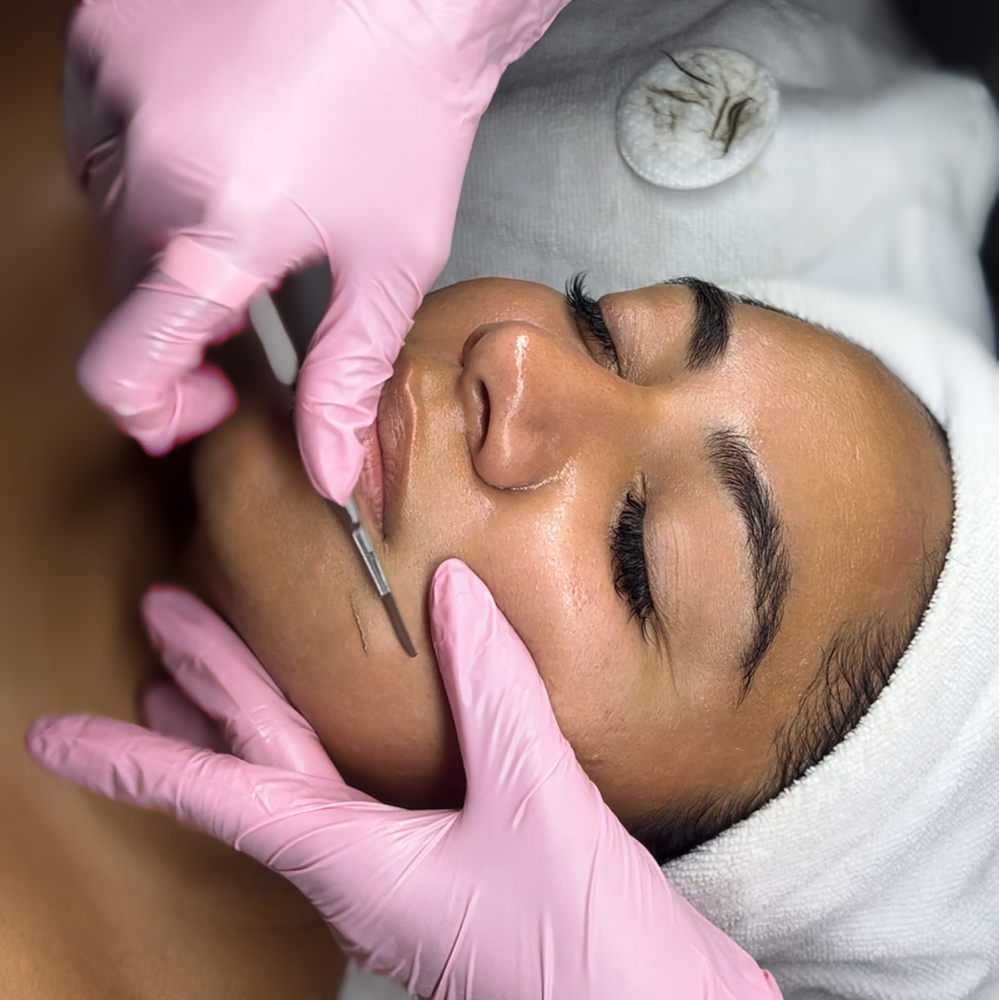 Dermaplane Facial