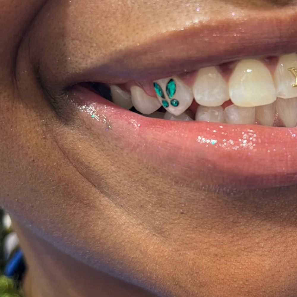 Butterfly Tooth Gem Design at Icey Bodies in St Anthony, MN