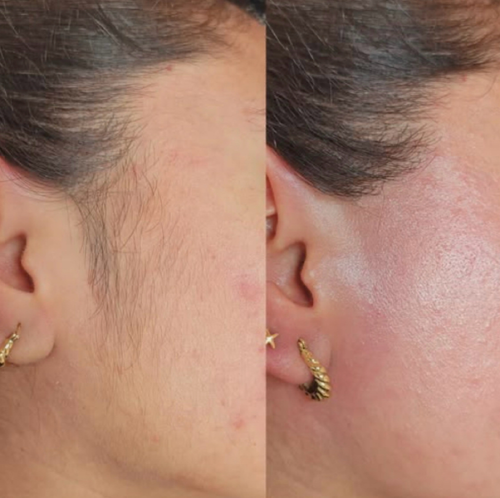 Side Burns Sugaring at Gegee's Spa on Devine in Columbia, SC
